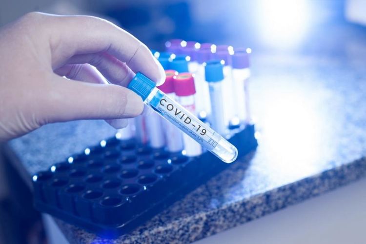 Строителен работник от Кърджали е новият заразен с COVID 19, тествал се по своя воля